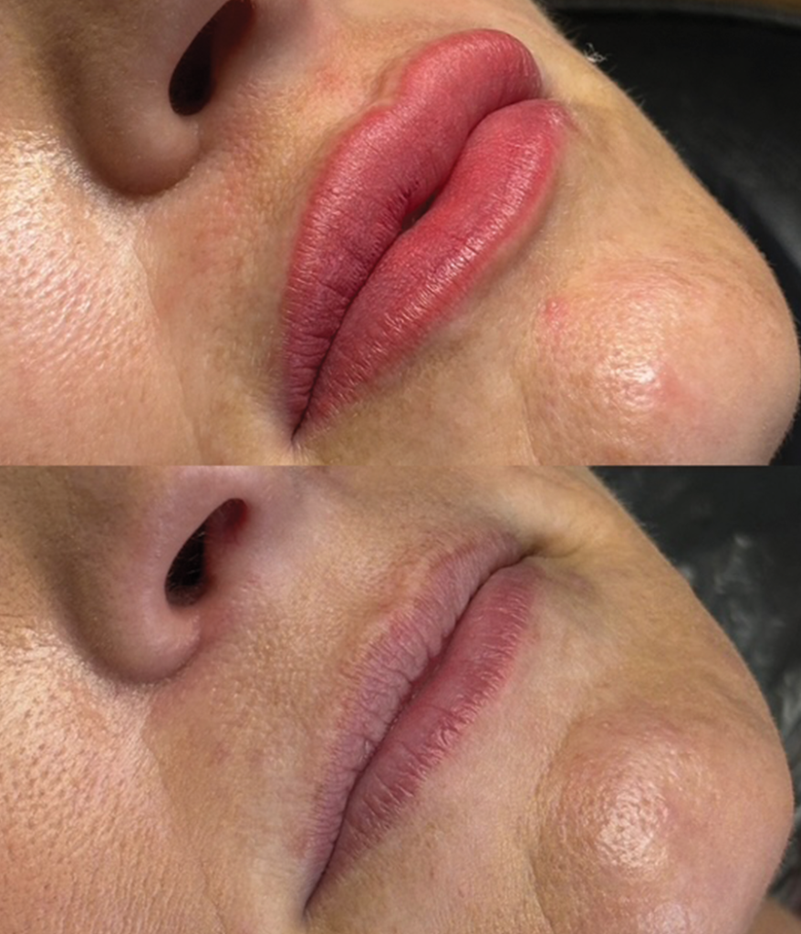 Permanent makeup lips close-up result